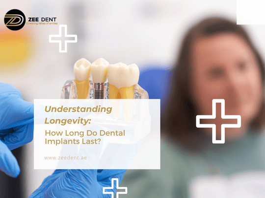 How Long Do Dental Implants Last