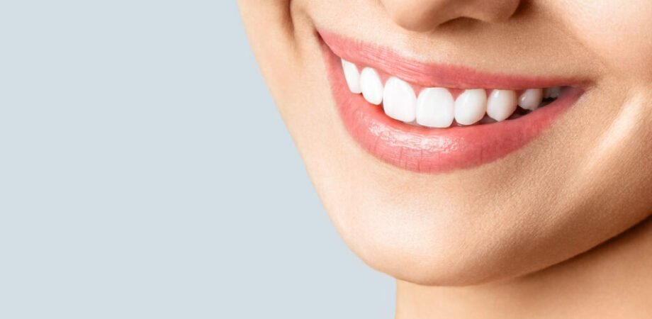 Teeth Transformation