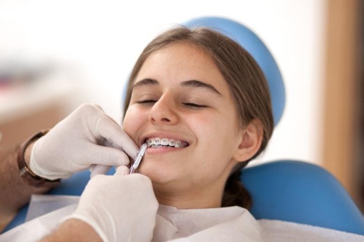 Care for your Braces